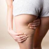 セルライトを除去するダイエットを行う際の水分の役割とは？