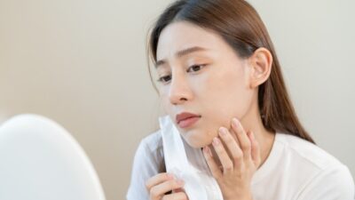 【保存版】運動不足だとニキビができやすい理由とは？